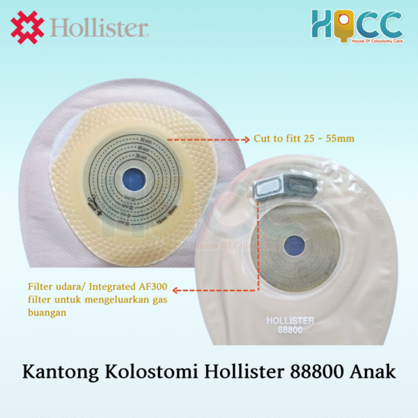 Kantong Kolostomi Hollister Anak 88800 - Gambar 2