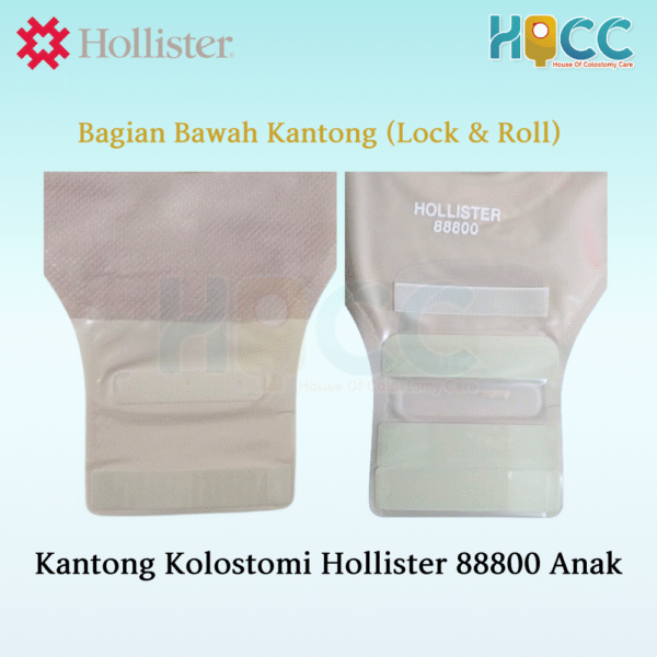 Kantong Kolostomi Hollister Anak 88800 - Gambar 3
