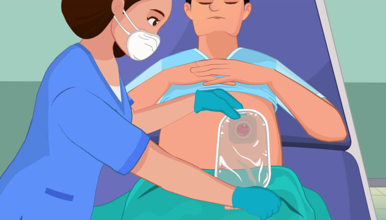 Peran Dukungan Keluarga dan Caregiver dalam Perawatan Ostomi